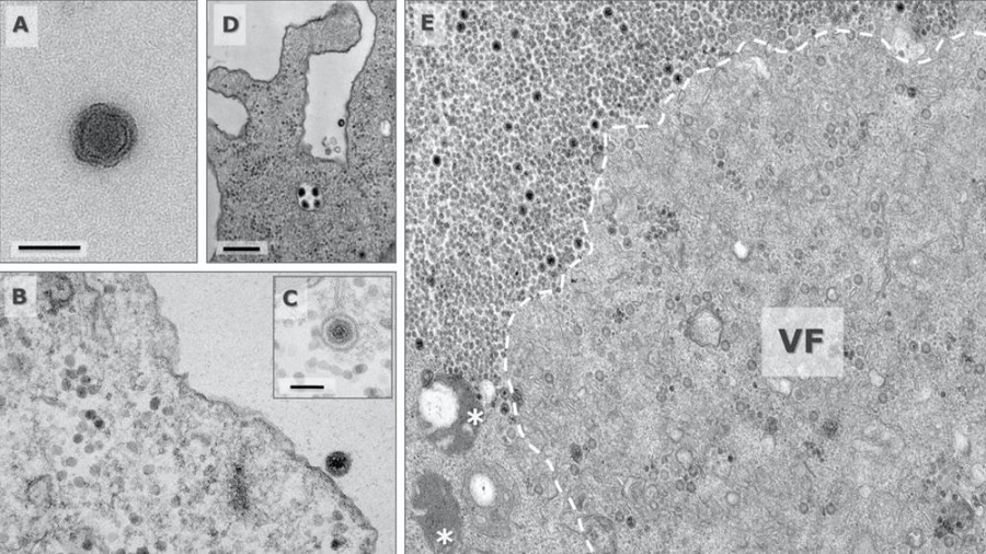 Микроскопоор шинэ төрлийн "Яравирус"-ийн харагдах байдал